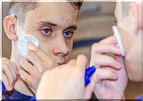 A teenager applying treatment to the skin. 