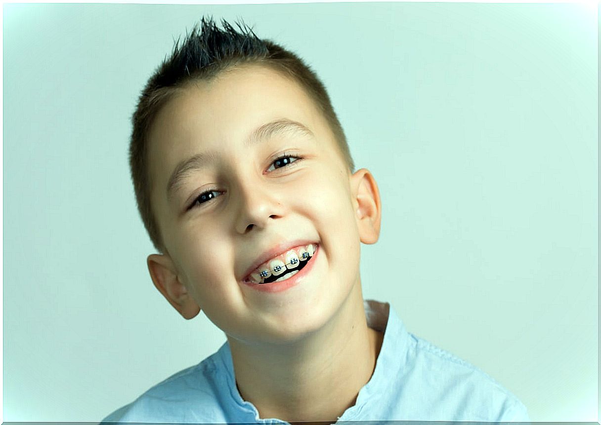 Child with braces.